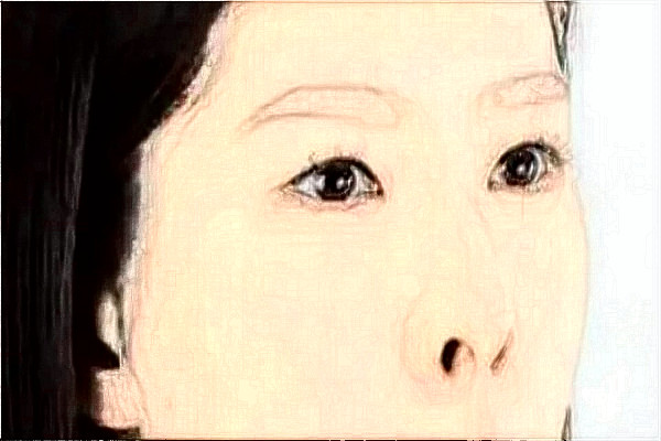 2024徐州醫(yī)科大學附屬醫(yī)院激光祛斑怎么樣_醫(yī)生介紹