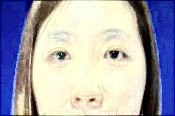 2024徐州醫(yī)科大學附屬醫(yī)院激光祛斑怎么樣_醫(yī)生介紹