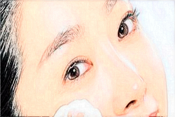 安徽醫(yī)科大學(xué)第一附屬醫(yī)院去眼袋做的好嗎?哪位醫(yī)生做得好