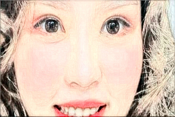 丹東市第一醫(yī)院割雙眼皮做的好嗎_案例_價格