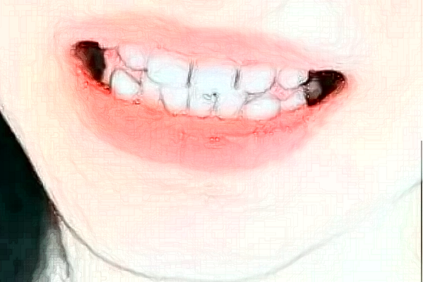 長(zhǎng)沙科爾雅口腔醫(yī)院牙齒矯正做的好嗎?哪位醫(yī)生做得好