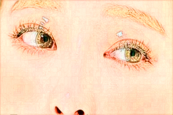 煙臺毓璜頂醫(yī)院隆鼻怎么樣?假體隆鼻能保持幾年?