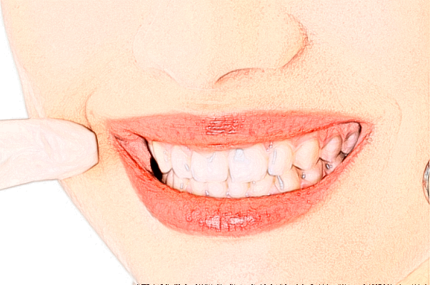 齊齊哈爾市中醫(yī)院全瓷牙怎么樣_誰(shuí)做得好