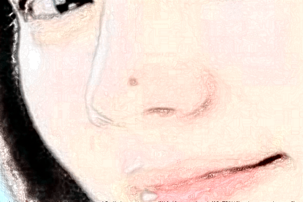 2024沈陽(yáng)盛京醫(yī)院去痣好不好?體驗(yàn)日記反饋