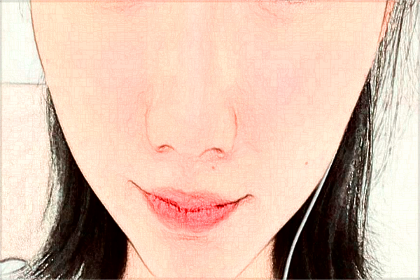 煙臺中醫(yī)院光子嫩膚好不好?2024光子嫩膚收費(fèi)價(jià)格