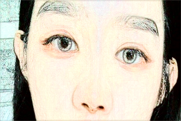 蘭州大學(xué)第二醫(yī)院激光祛斑怎么樣?激光祛斑的恢復(fù)期