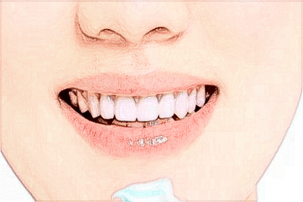 武漢大學口腔醫(yī)院種植牙技術好嗎?全口牙種植好不好?