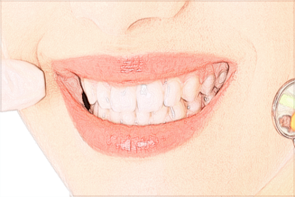 武漢大學口腔醫(yī)院種植牙技術好嗎?全口牙種植好不好?