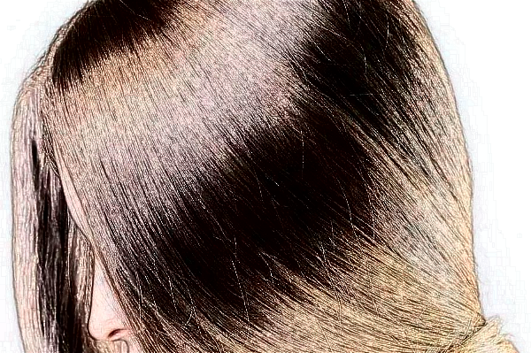 河北省人民醫(yī)院植發(fā)怎么樣_誰(shuí)做得好