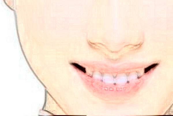 2024延邊醫(yī)院祛斑價格是多少?那個醫(yī)生好