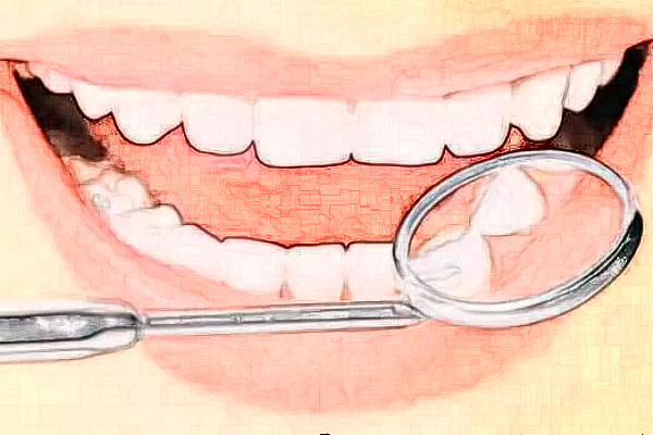 2024上海華美醫(yī)療美容醫(yī)院半口牙種植怎么樣_誰(shuí)做得好