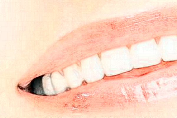 2024天津南開醫(yī)院烤瓷冠怎么樣|醫(yī)生介紹|價格收費