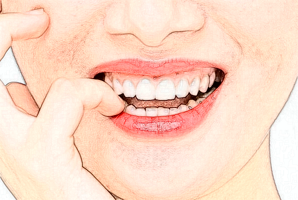 2024無錫市人民醫(yī)院口腔修復做的好嗎_醫(yī)生推薦