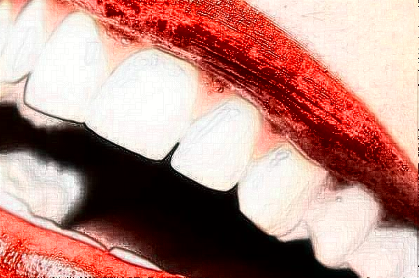 2024山西省人民醫(yī)院牙齒矯正費(fèi)用多少?整形日記全過程