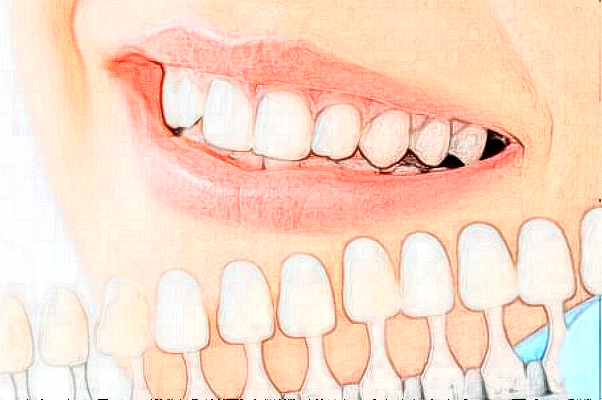 2024遼寧省人民醫(yī)院拔牙怎么樣|醫(yī)生介紹|價格收費