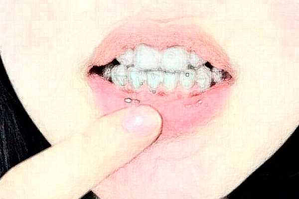 齊齊哈爾市中醫(yī)院正畸怎么樣_誰(shuí)做得好