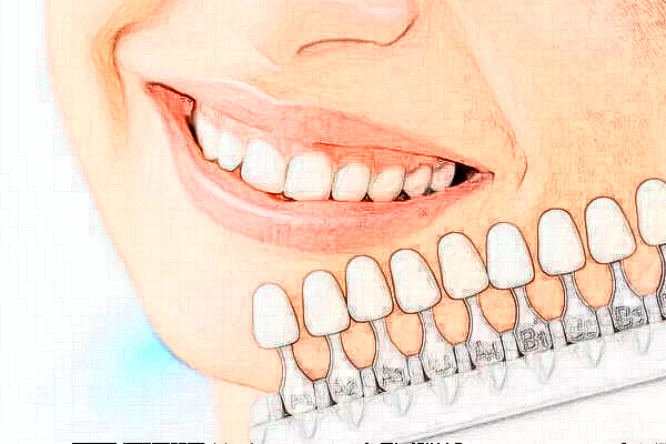 2024長沙好大夫口腔醫(yī)院地包天矯正怎么樣_價格表_案例_地址