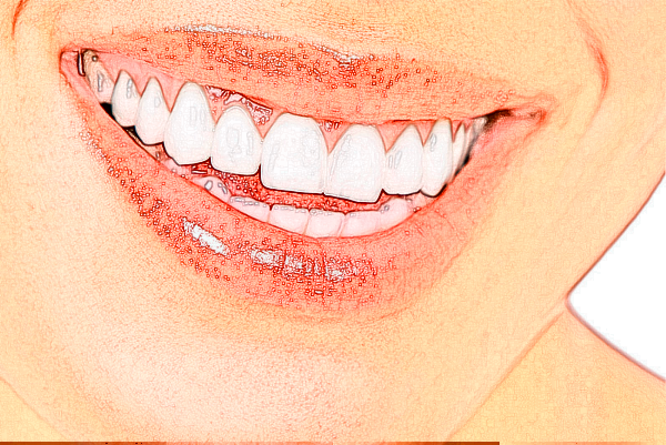 自貢華醫(yī)口腔醫(yī)院種牙好不好?種牙的好處與危害