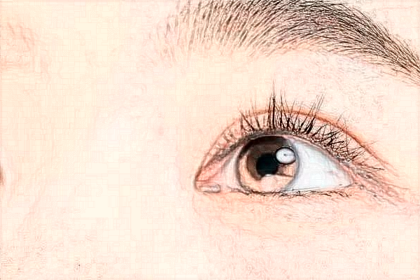 2024煙臺毓璜頂醫(yī)院去眼袋價格?割眼袋能保持幾年