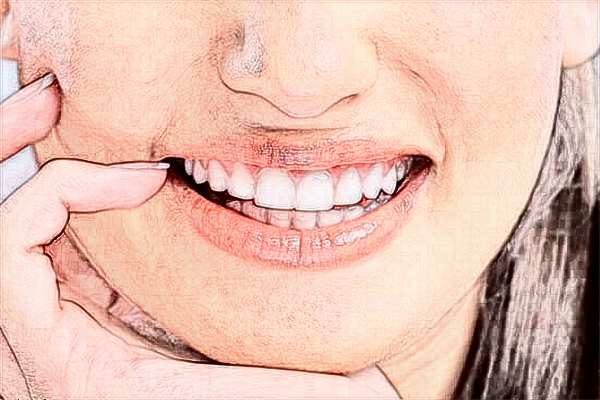 2024青島市立醫(yī)院根管牙齒價(jià)格?根管裂開(kāi)了怎么辦