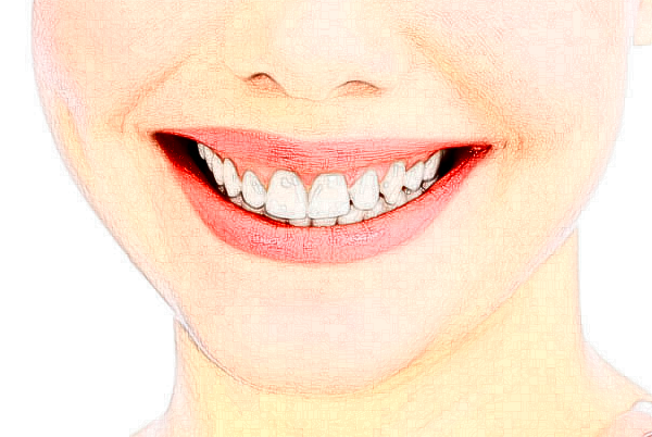 無(wú)錫市人民醫(yī)院地包天矯正價(jià)位多少?專(zhuān)家介紹