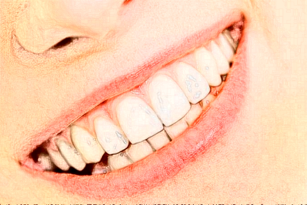 2024無(wú)錫市人民醫(yī)院牙齒矯正好嗎?附價(jià)格表+案例