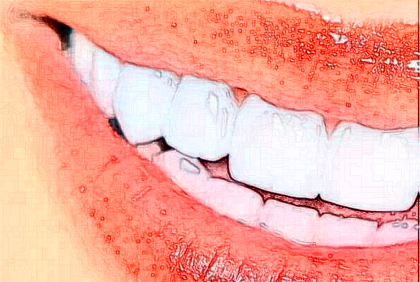 2024銅陵市人民醫(yī)院牙齒種植好嗎?附價(jià)格表+案例