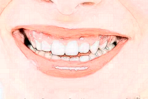 河北大學附屬醫(yī)院全口種植費用多少_醫(yī)生名單