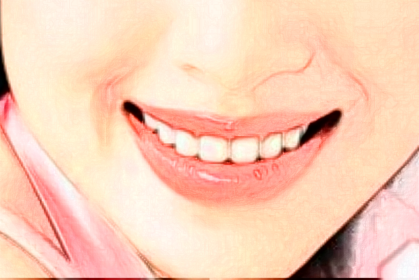 鄭州植得口腔醫(yī)院牙齒矯正怎么樣?牙齒矯正年齡范圍