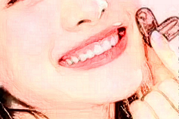 2024成都新橋口腔醫(yī)院牙齒矯正費(fèi)用?牙齒矯正會(huì)改變臉型嗎?