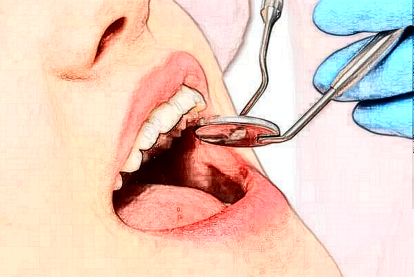 山西省人民醫(yī)院錯頜畸形矯正費用多少?整形日記全過程