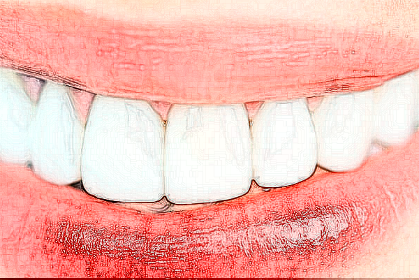 2024銅陵市人民醫(yī)院牙齒美白價(jià)位多少?專家介紹