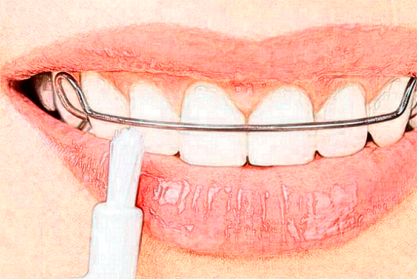 河北大學附屬醫(yī)院正畸怎么樣|醫(yī)生介紹|價格收費