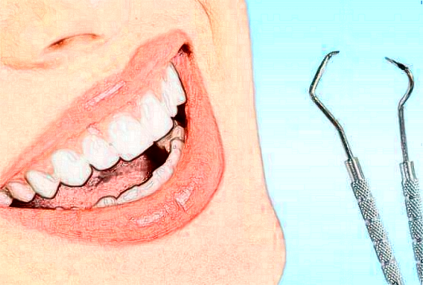 河北大學附屬醫(yī)院正畸怎么樣|醫(yī)生介紹|價格收費