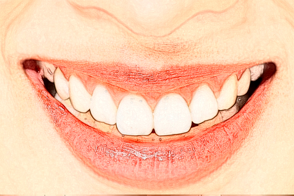 2024遼寧省人民醫(yī)院瓷貼面價(jià)目表全新發(fā)布!案例反饋