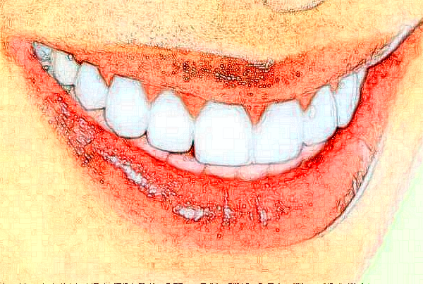 遼寧省人民醫(yī)院根管費用多少?整形日記全過程