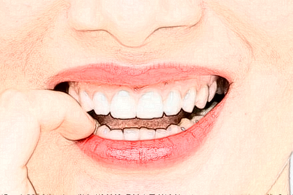 成都茁悅口腔正畸做的好嗎?哪位醫(yī)生做得好