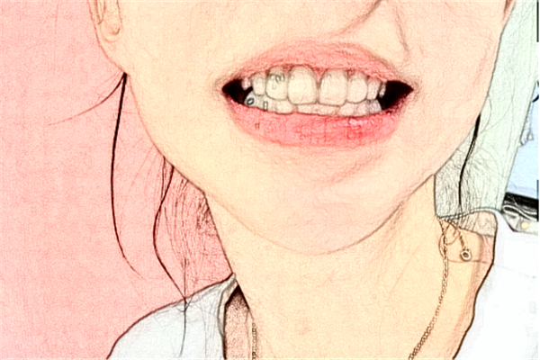 北京牙管家口腔診所補(bǔ)牙怎么樣|醫(yī)生介紹|價(jià)格收費(fèi)