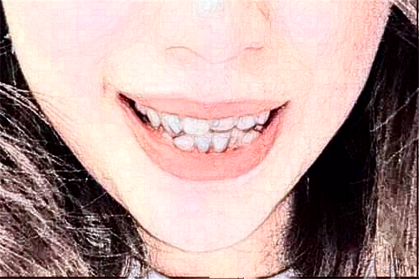 2024杭州植得口腔門診部全瓷牙怎么樣?醫(yī)生介紹_案例分享