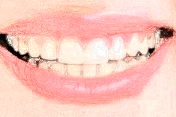 北京牙管家口腔診所隱適美怎么樣|醫(yī)生介紹|價格收費