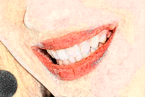 2024貴陽柏德口腔醫(yī)院補(bǔ)牙怎么樣_體驗(yàn)日記分享