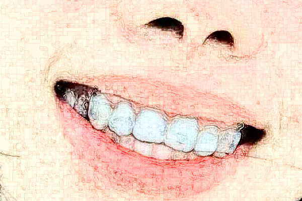 2024鄭州植得口腔醫(yī)院拔牙多少錢(qián)?拔牙的危害