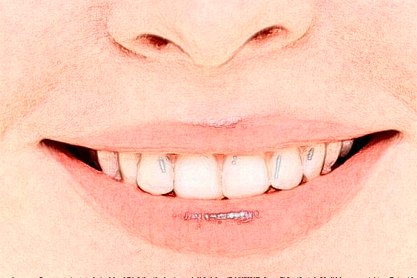 重慶團(tuán)圓口腔醫(yī)院補(bǔ)牙好不好?補(bǔ)牙醫(yī)生推薦名單