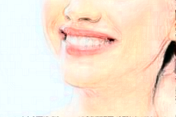 2024福州福能海峽口腔醫(yī)院拔牙怎么樣_醫(yī)生排名介紹