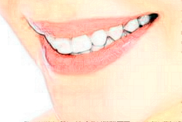 2024福州福能海峽口腔醫(yī)院拔牙怎么樣_醫(yī)生排名介紹