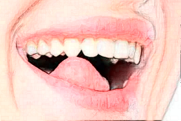 淮安諾貝爾口腔醫(yī)院全口種植怎么樣，附醫(yī)生信息一覽~