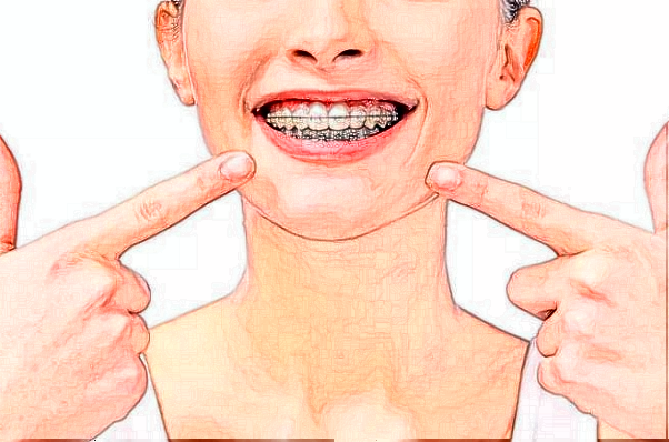 杭州植得口腔門診部牙齒美白好的醫(yī)生推薦_美容日記展示