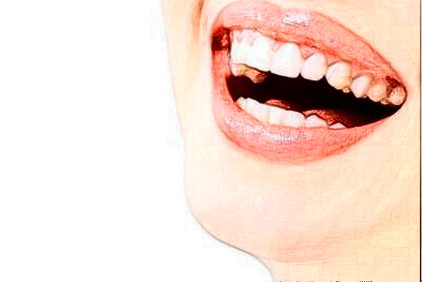 2024太原眾牙口腔醫(yī)院怎么樣？值得去嗎