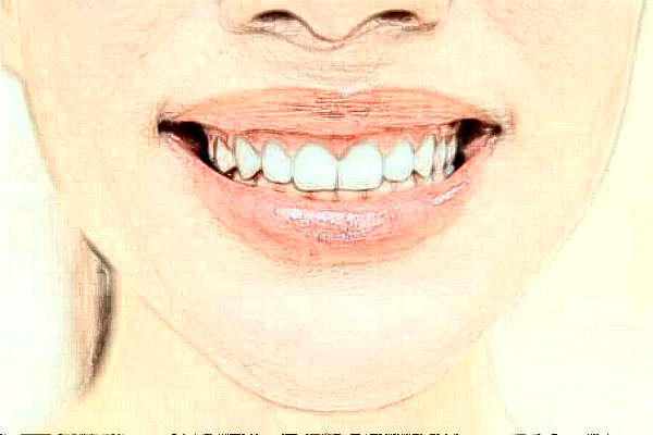 襄陽新德恩口腔門診部全口牙種植怎么樣_誰做得好