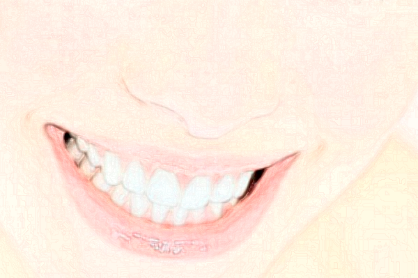 天津南開醫(yī)院前牙種植費(fèi)用多少_醫(yī)生名單